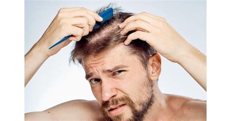 Hair Loss Treatment For Men Surgical And Non Surgical Options