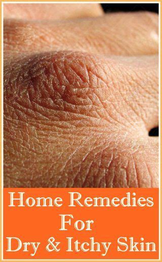 Home Remedies For Dry And Itchy Skin Dry Itchy Skin Brown Spots On