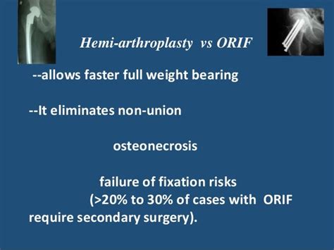 Role Of Hemiarthroplasty 30th Aug 2015