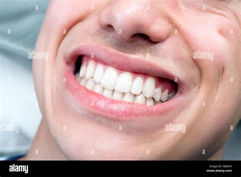 Perfect Teeth Smile Man