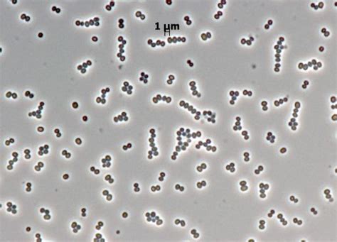 Staphylococcus Warneri E15 Dsm 30870 Bacdiveid14593