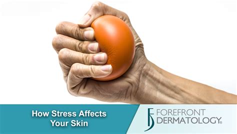 The Stress Effect How Stress Impacts Skin Health Forefront Dermatology