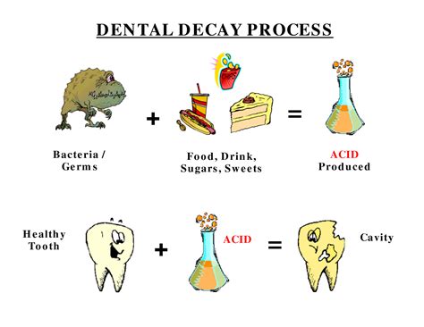 Common Causes Of Dental Cavities