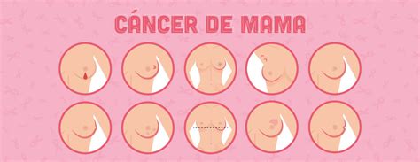 Cancer De Tetas