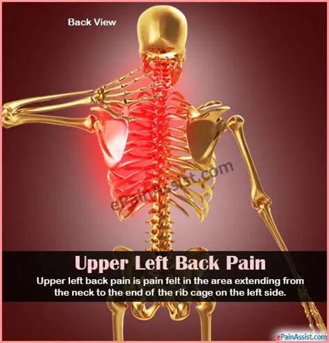 The 23 Hidden Facts Of Organ Pain In Left Side Of Back All Of These