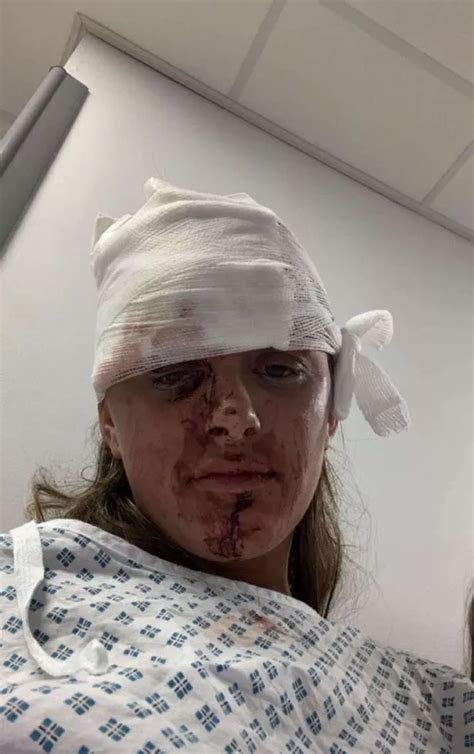 Teen Fears She Is Scarred For Life After Being Lured And Bottled On Night Out Hull Live