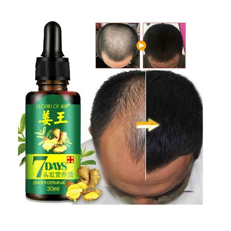 Repair your damaged hair and nourish it with the aid of advanced hair serum brands formulae and products at alibaba.com. 7 Day Ginger Germinal Hair Growth Serum Hairdressing Oil ...