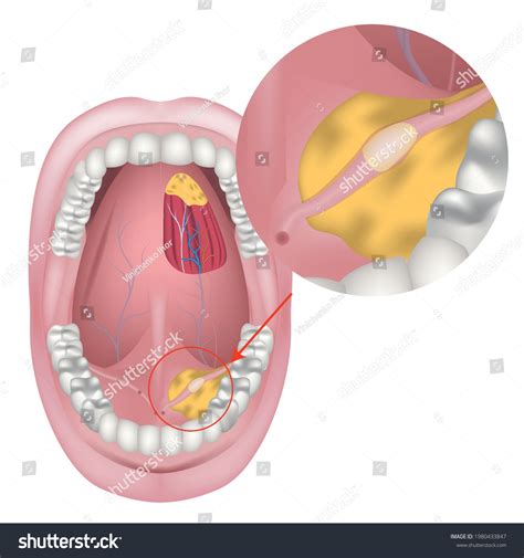 Mouth Salivary Duct Diagram 2 Billeder Stock Fotos Og Vektorer