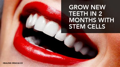Grow New Teeth In Just Two Months With Stem Cell Implants Healing Oracle