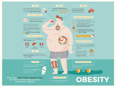 What Is Obesity Overview Of Obesity Blue Guys News