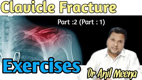 Clavicle Fracture Physiotherapy Exercise Clavicle Fracture Exercises