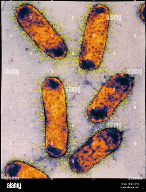 Escherichia Coli Coloured Transmission Electron Micrograph Tem Of