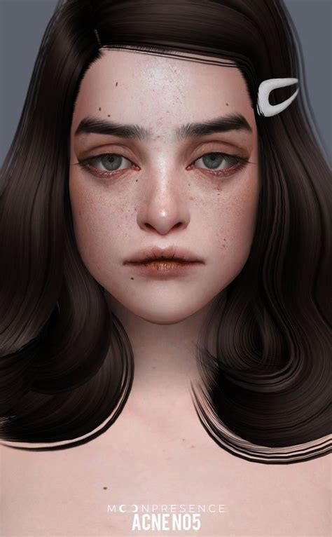 Acne N05 07 ᴍᴏᴏɴ ᴘʀᴇsᴇɴᴄᴇ Sims 4 Cc Skin Sims Sims Mods