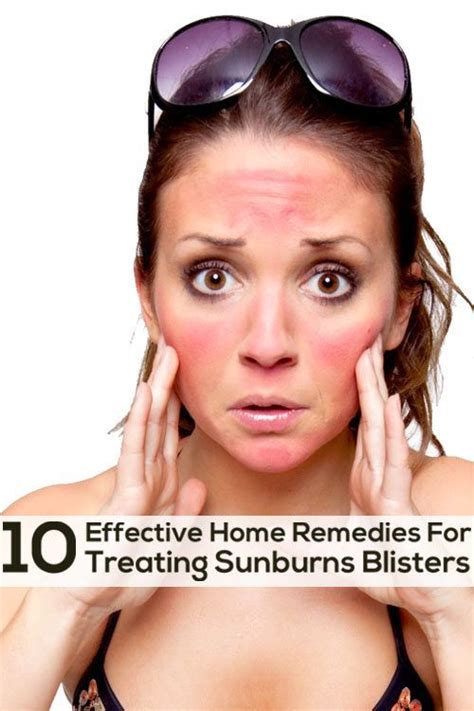 Beauty And Health Top 10 Effective Home Remedies For Treating Sunburn