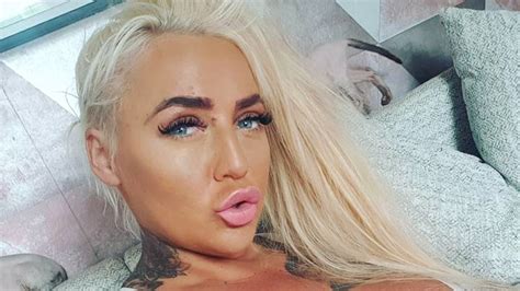 porn star rushed to hospital after lip filler operation goes wrong ladbible