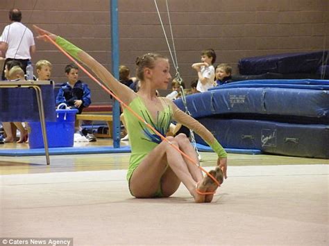 Scottish Gymnast Thought Vitiligo Was From ‘bad Tan Lines Daily Mail