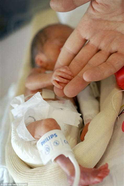 Ultra Premature Babies Grow Up But Their Struggles Are Far From Over