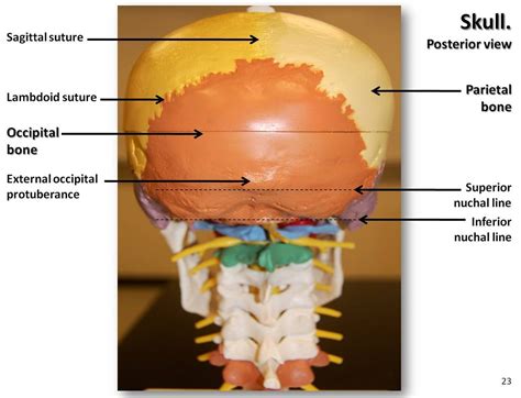Bones that form the sides of the head. Multi-colored Skull, posterior view with labels - Axial Sk ...