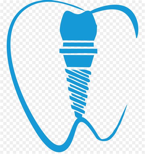 Dental Implant Clipart 20 Free Cliparts Download Images On Clipground