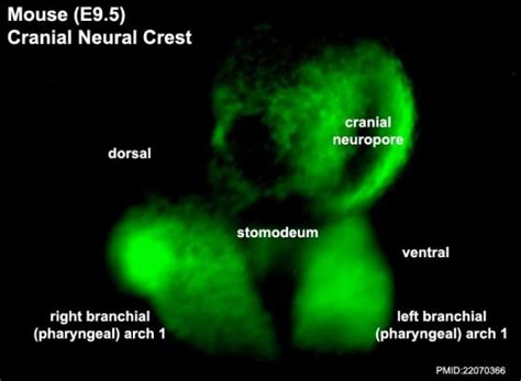 Mouse Cranial Neural Crest Migration Movie Embryology