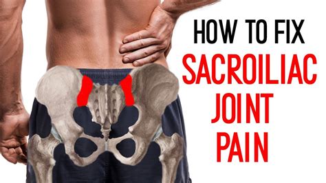 7 Best Sacroiliac Joint Pain Exercises And 5 To Avoid