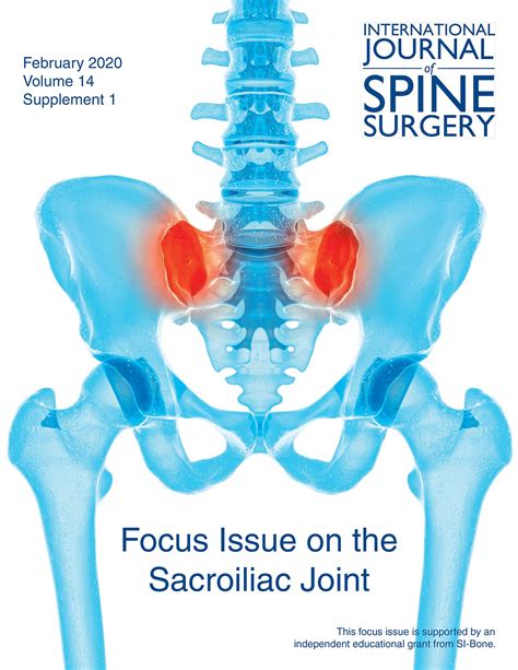 Nonoperative Treatment Options For Patients With Sacroiliac Joint Pain International Journal