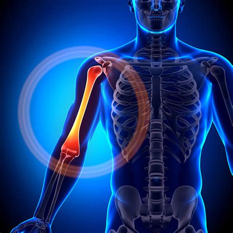 Upper Arm Pain Causes Symptoms Upper Arm Injuries Physio Pretoria