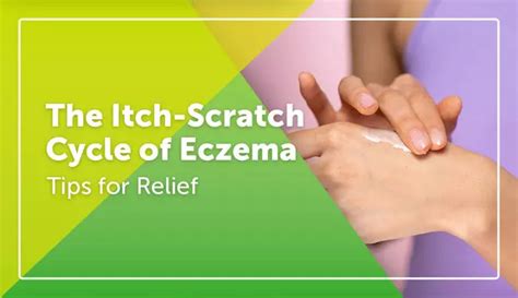 The Itch Scratch Cycle Of Eczema Tips For Relief Myeczemateam