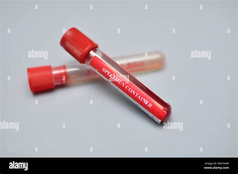 Vacutainer Tube Hi Res Stock Photography And Images Alamy