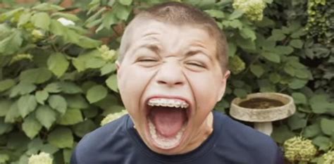 Watch Teen Breaks World Record Of Widest Mouth Opening