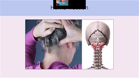 Common Headache Back Head Pain And Neck Pain Techniques Youtube