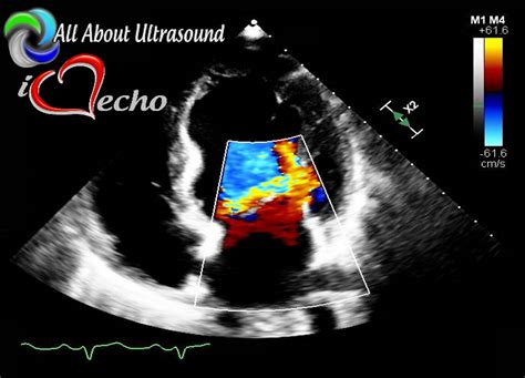 Adult Echo And Ultrasound Physics Registry Review Bundle