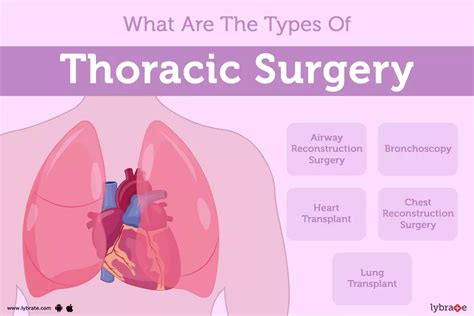 Thoracic Surgery Purpose Procedure And Benefits And Side Effects