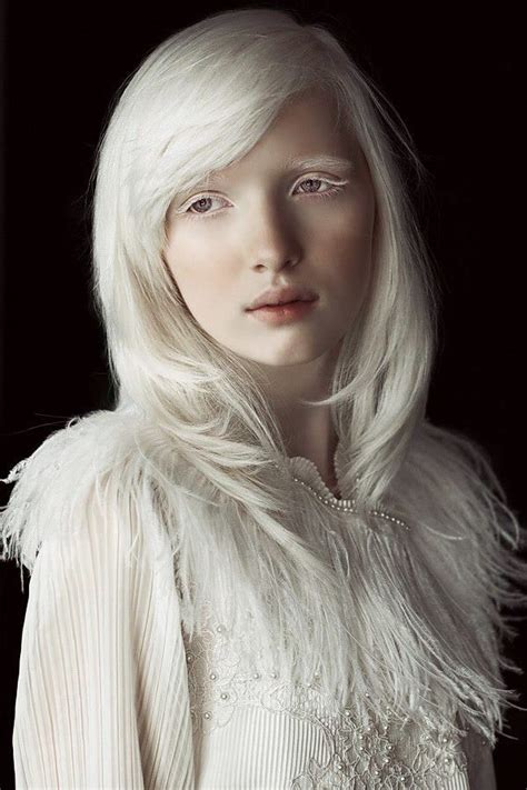 Nastya Zhidkova Albino Russian Model Albino Model Albino Girl