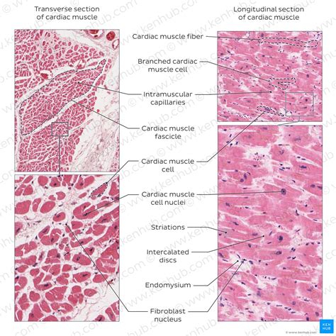 Cardiac Muscle Histology Slide Identification Anatomy Online Cardiac