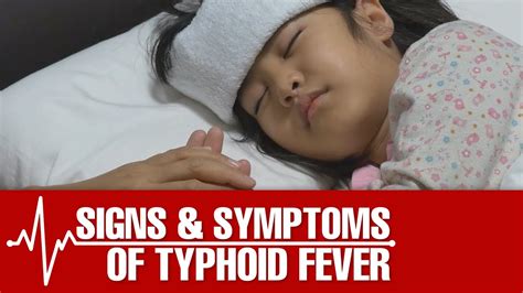 Signs And Symptoms Of Typhoid Fever Youtube