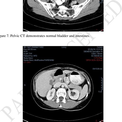 Normal Ct Of Abdominal Organs Download Scientific Diagram