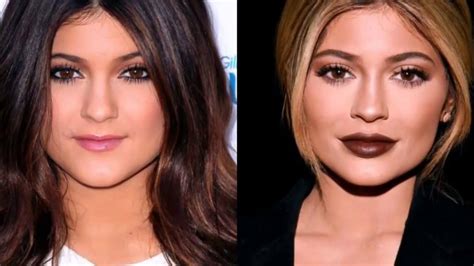 Of The Most Drastic Celebrity Plastic Surgeries Celebrity Plastic