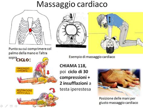 Riorganizzare Grado Braccio Insufflazioni Massaggio Cardiaco Acqua Di Seltz Indice Amico