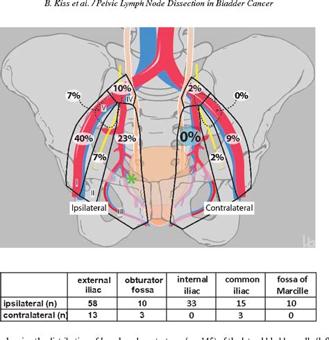 Pdf Pelvic Lymph Node Dissection May Be Limited On The Contralateral