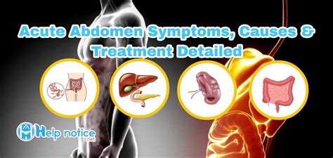 Acute Abdomen Symptoms Causes And Treatment Best Helpful Site In World
