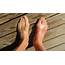 How To Deal With The Swelling Of Top Your Foot  MD Healthcom