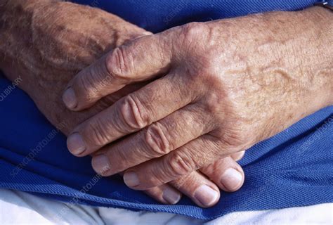 Elderly Hands Stock Image P7010212 Science Photo Library
