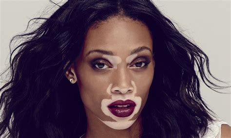 Chantelle Winnie A Model In Demand In Pictures Global The Guardian