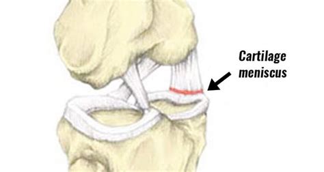 Medial Knee Pain Inside Symptoms Causes Treatment And Rehab