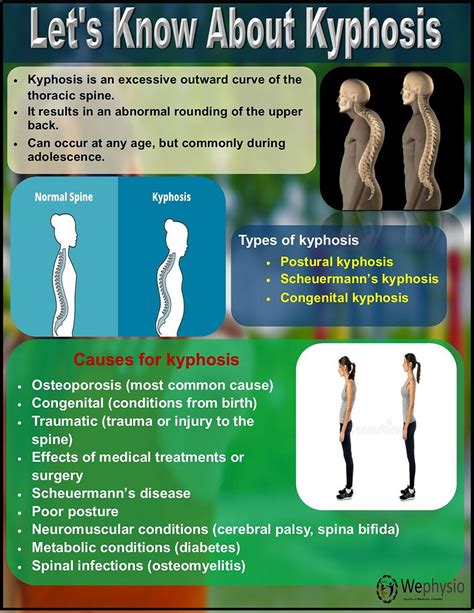 Lets Know About Kyphosis