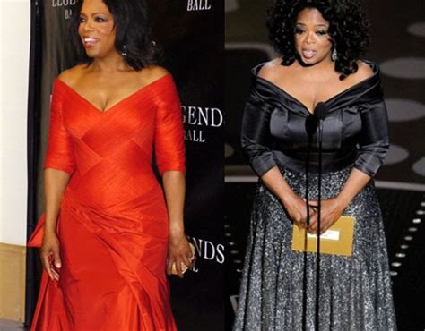 Oprah Winfrey Nose Job Before And After Photo Celebrity Plastic Surgery