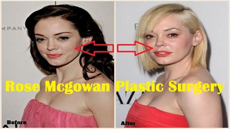 Rose Mcgowan Plastic Surgery Before And After Youtube