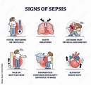 Signs of sepsis as infection blood poisoning symptoms outline ...