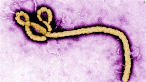 Ebola Virus 9 Things To Know About The Killer Disease